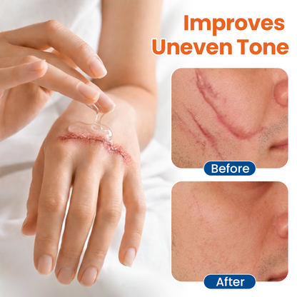 DermalRebuild® Skin Renewal Gel