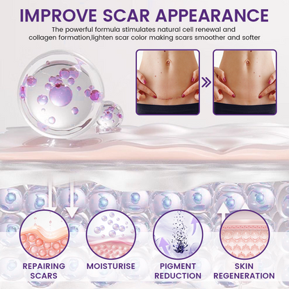 ReGenScar® Stem Cell Scar Gel