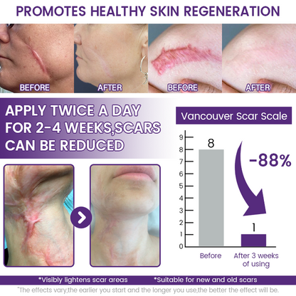 ReGenScar® Stem Cell Scar Gel