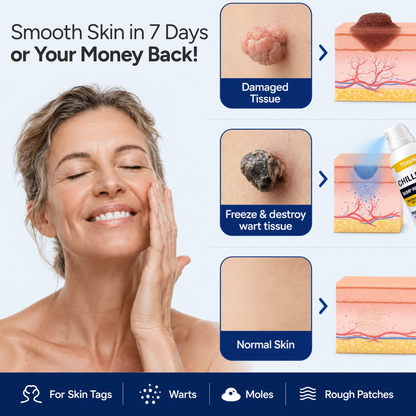 ChillErase® Precision Skin Tag & Wart Removal Spray
