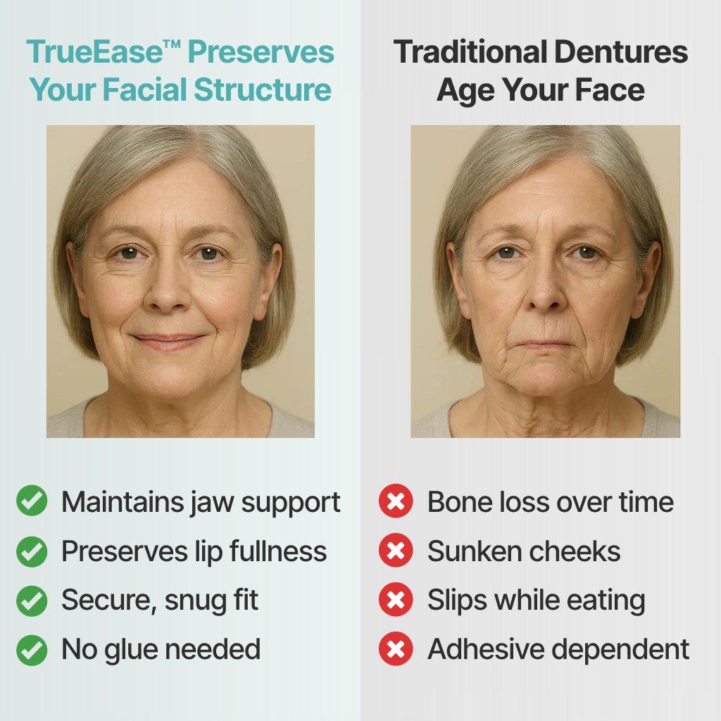TrueEase™ Custom-Fit Full Functional Dentures