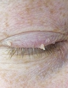 Before image for Cynthia Murphy